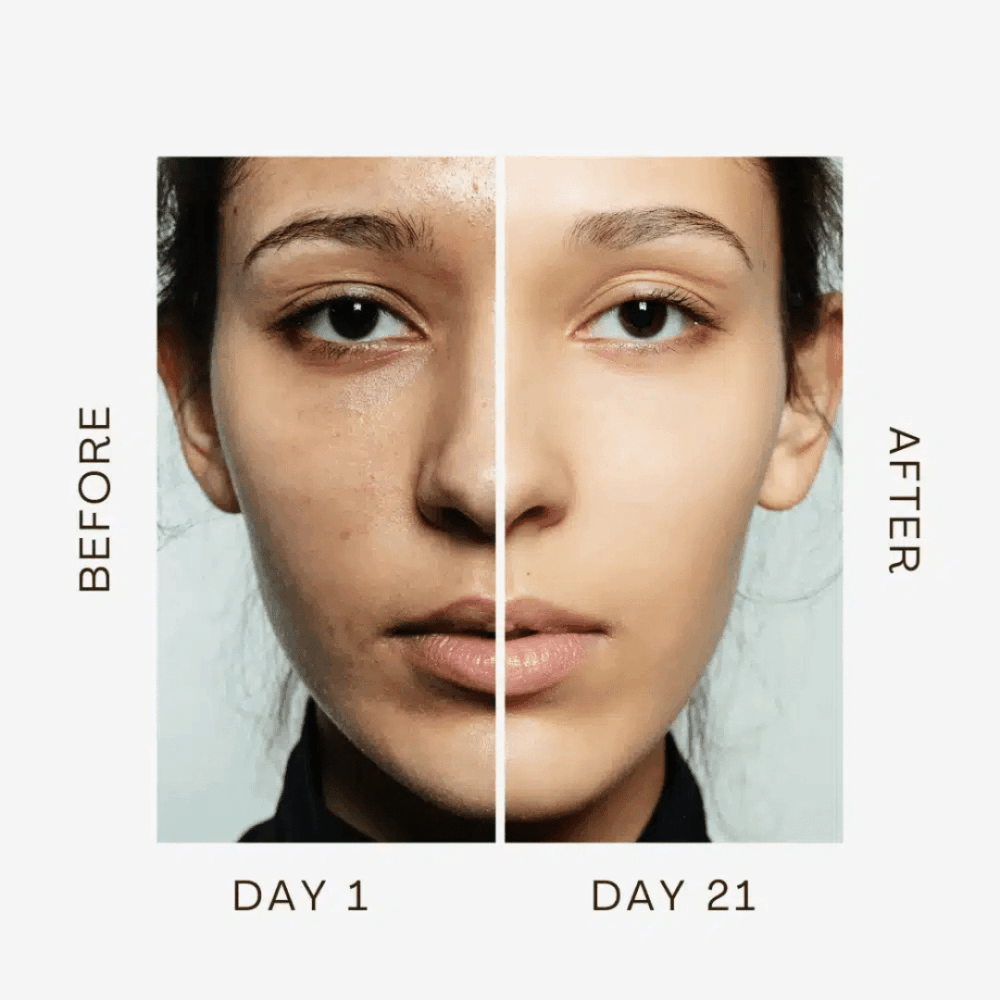 Luminesce Glow Before and After
